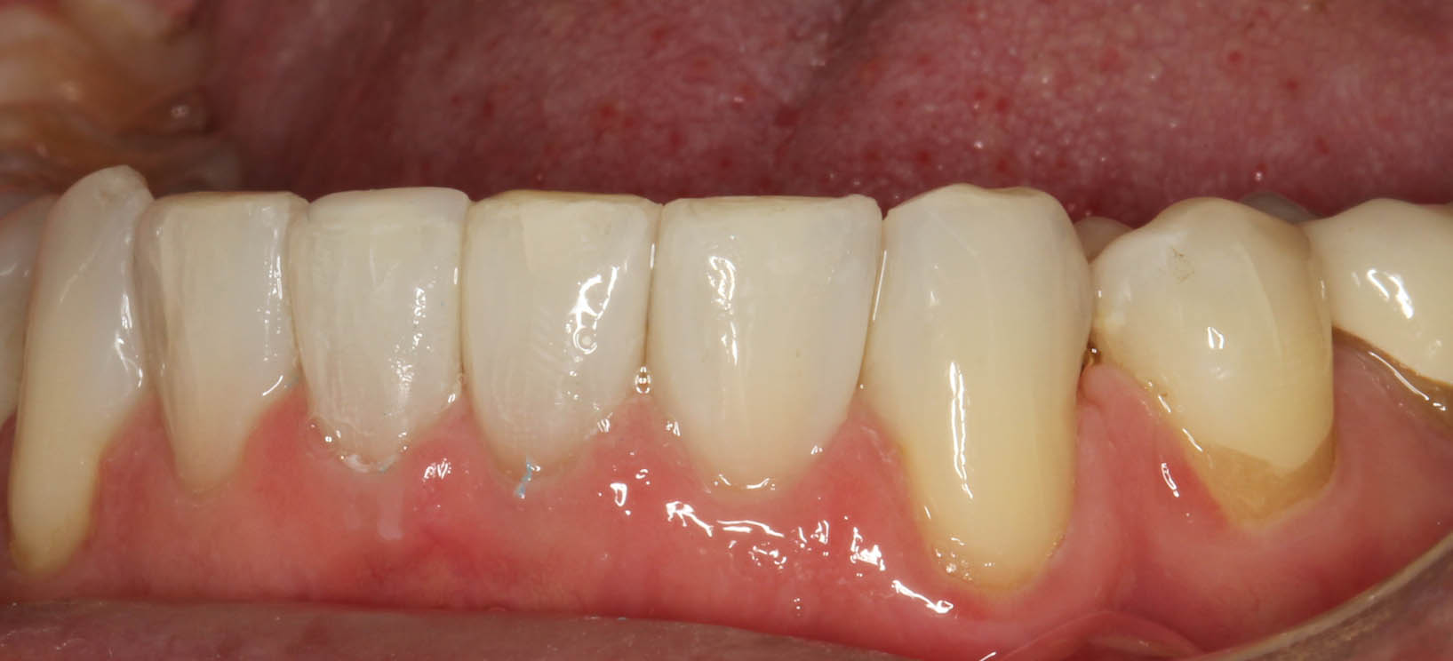 » Categories » Bioclear Restorations